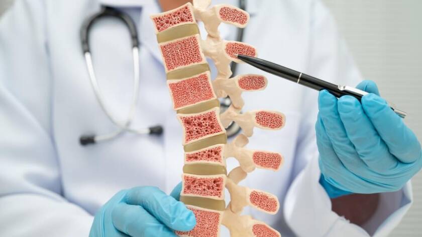 doctor-holding-osteoporosis-back-bone-model